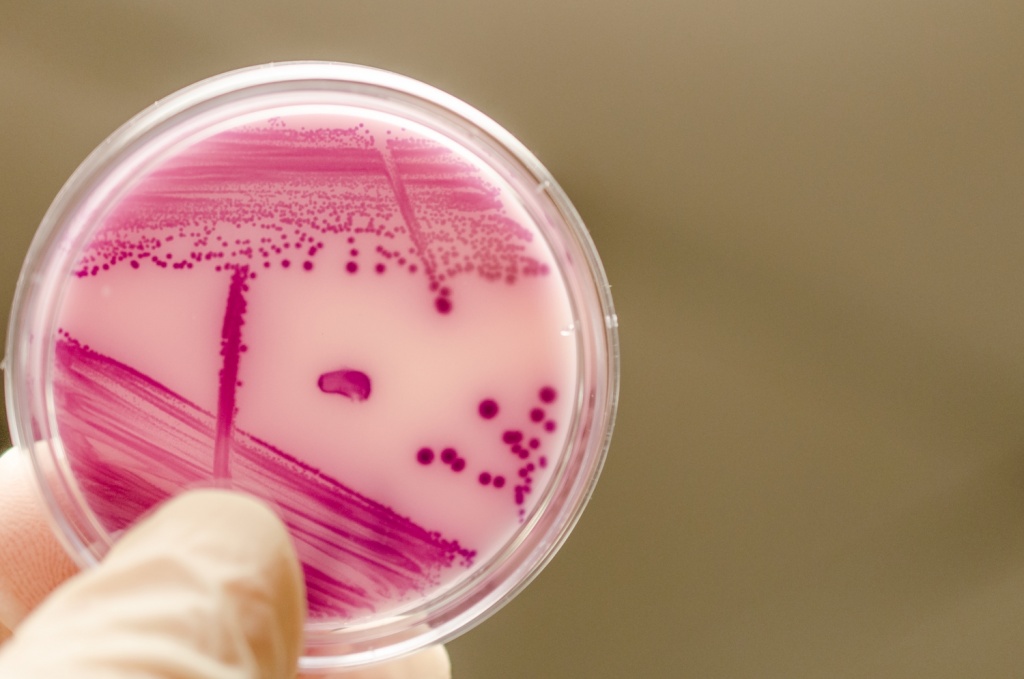 İnsan Kaynaklı Bakteri Taşıyıcılığını (Listeria/E.Coli) Sıfıra İndiren Personel Hijyen Algoritması